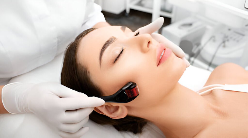 Microneedling Procedure