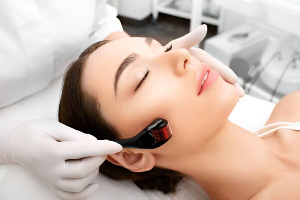 Microneedling Procedure